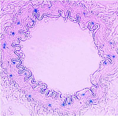 Prostaglandin F2-alpha Receptor